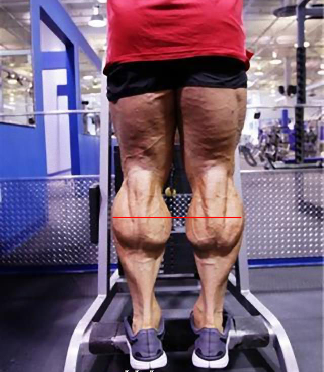 Ноги у толстых людей. Самые большие икроножные мышцы. Мощная голень. Огромные накаченные икры.